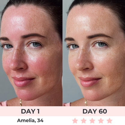 AuraGlow™ - LED Face Mask